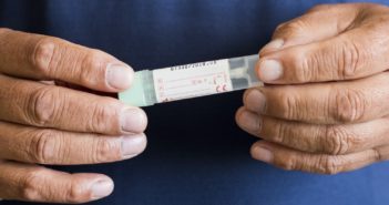 Vastagbélrák szűrés – Férfiaknál hatásosabb, mint nőknél