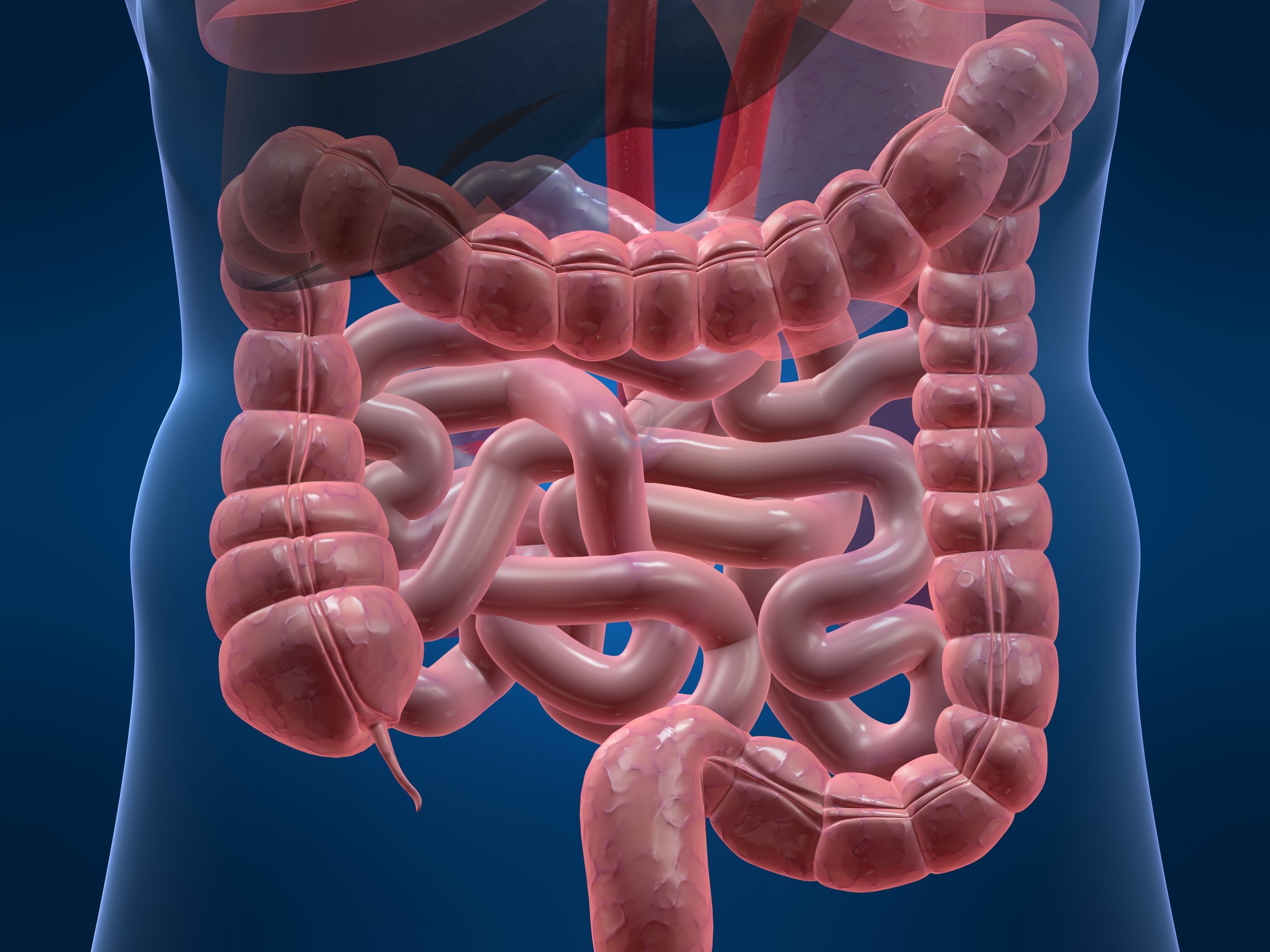 bélférgek Crohn s)