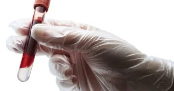 70 ezer hepatitis C-fertőzött lehet Magyarországon