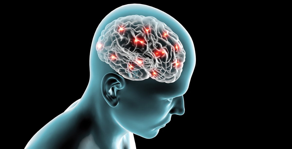 Új terápiás utat nyithat az agyi infarktus kezelésében magyar kutatók ...