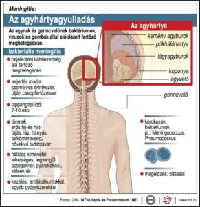 agyhartyagyulladas-MTI