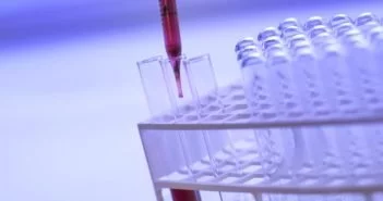 Évente tízezer vastagbélrák-megbetegedést diagnosztizálnak