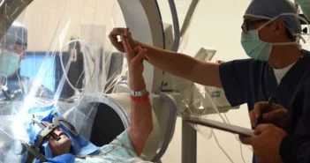 Mély agyi stimulációval próbálják felvenni a harcot az Alzheimer-kór ellen amerikai kutatók