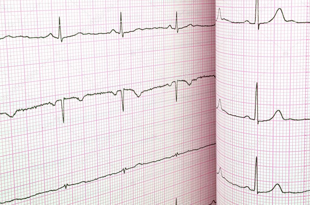 Kardológia, EKG, szívultrahang a Mária Medical Magánrendelőben