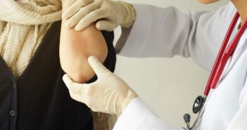 A pikkelysömör korszerű kezelése ma már elérhető a bőrgyógyászati centrumokban