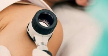 Változó életmódi szokások, növekvő UV- terhelés a melanoma hátterében – Interjú dr. Hufnagel Csilla bőrgyógyásszal