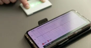 Országos szintre emelnék a Városmajori Szív- és Érgyógyászati Klinikán működő kardiológiai koordinátori programot