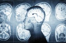 Az emberi agysejtek evolúciója összefüggésben állhat az autizmussal