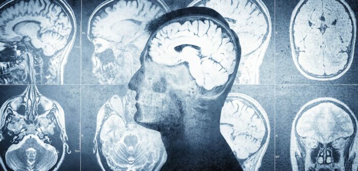 Az emberi agysejtek evolúciója összefüggésben állhat az autizmussal