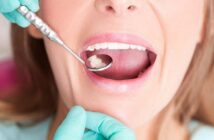 November, a fogászati hónap