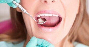 November, a fogászati hónap