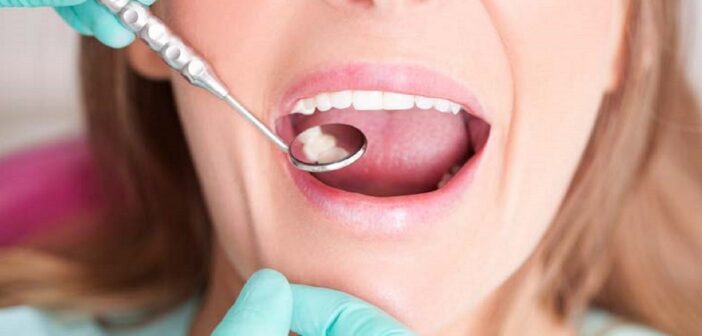 November, a fogászati hónap